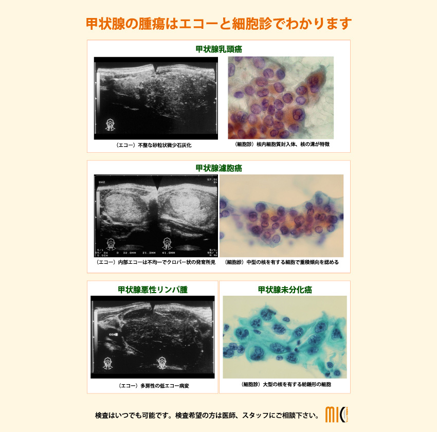 くびのおはなし 鹿児島 耳鼻科の耳鼻咽喉科ミック